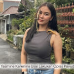 Sensasi Baru Yasmine Karenina Usai Opas! Wajah dan Tubuh Bak Reborn, Netizen: "Kayak Bukan Orang yang Sama!"