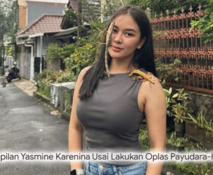 Sensasi Baru Yasmine Karenina Usai Opas! Wajah dan Tubuh Bak Reborn, Netizen: "Kayak Bukan Orang yang Sama!"