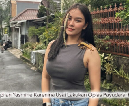 Sensasi Baru Yasmine Karenina Usai Opas! Wajah dan Tubuh Bak Reborn, Netizen: "Kayak Bukan Orang yang Sama!"