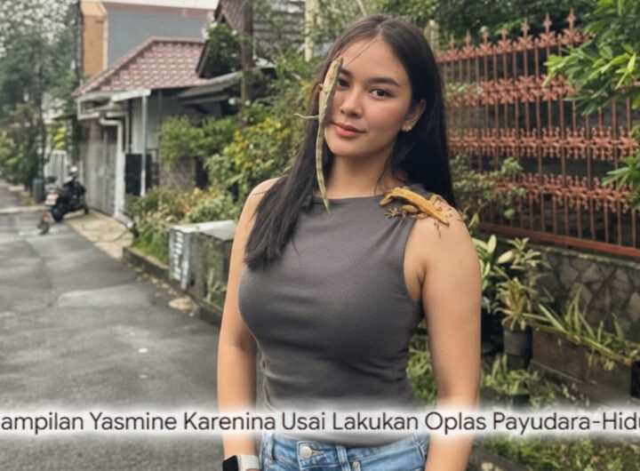 Sensasi Baru Yasmine Karenina Usai Opas! Wajah dan Tubuh Bak Reborn, Netizen: "Kayak Bukan Orang yang Sama!"